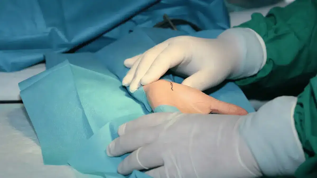 Artroscopia do Punho: Quais são os Benefícios